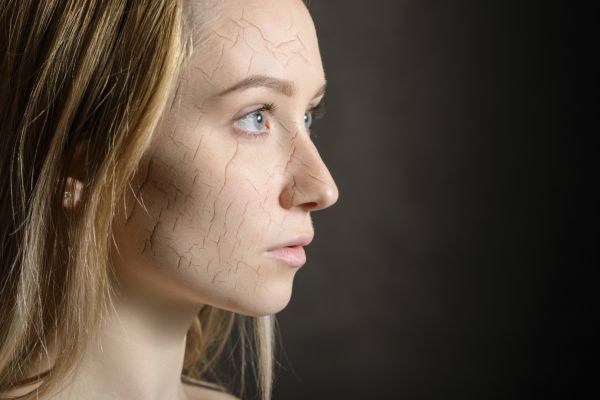 Érzékeny a bőröm, érzékeny a lelkem is?